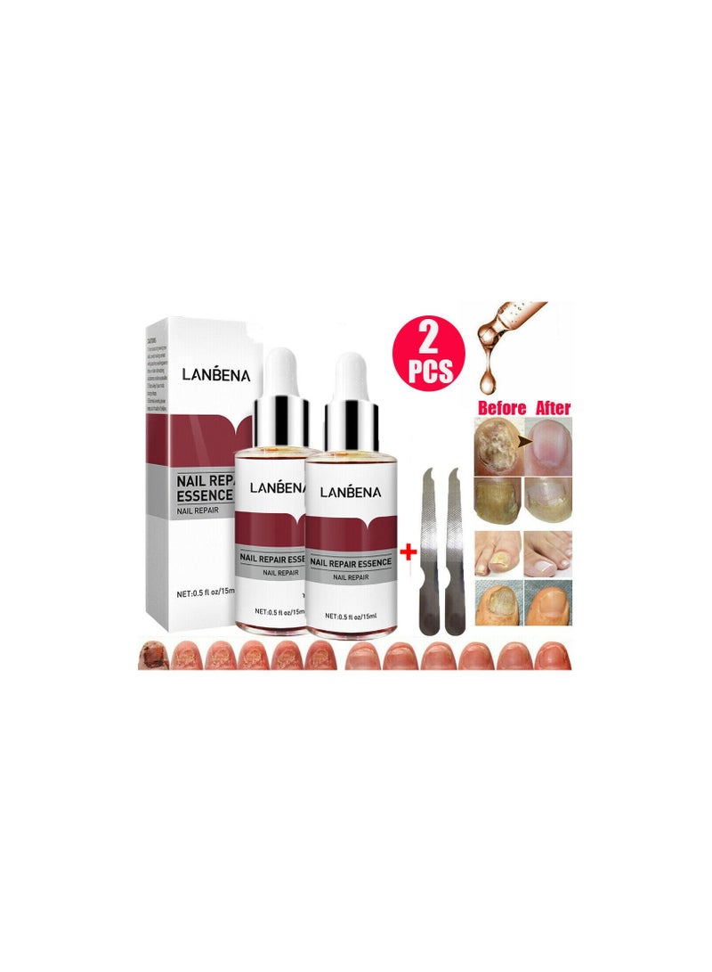 LANBENA Lanbena Nail Repair Essence 15ML  - Image 2