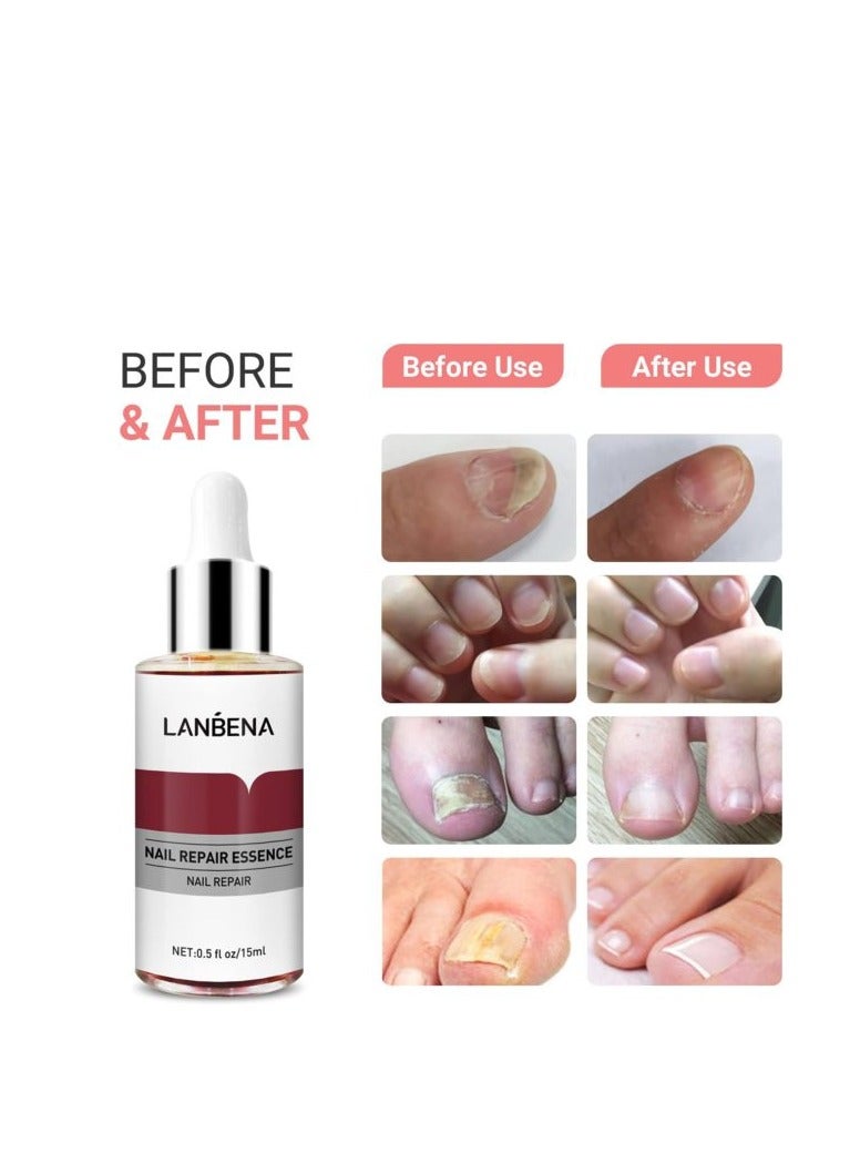 LANBENA Lanbena Nail Repair Essence 15ML  - Image 5