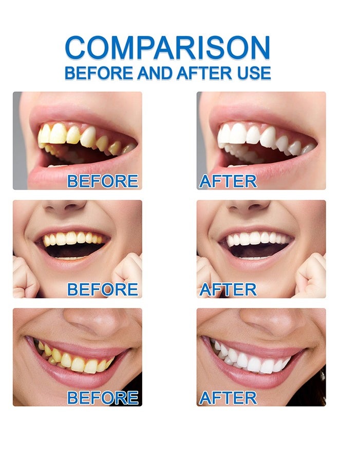 Teeth Whitening Serum For Fresh Breath, Teeth Whitening and Healthier Teeth & Gums Teeth Whitening for Men and Women