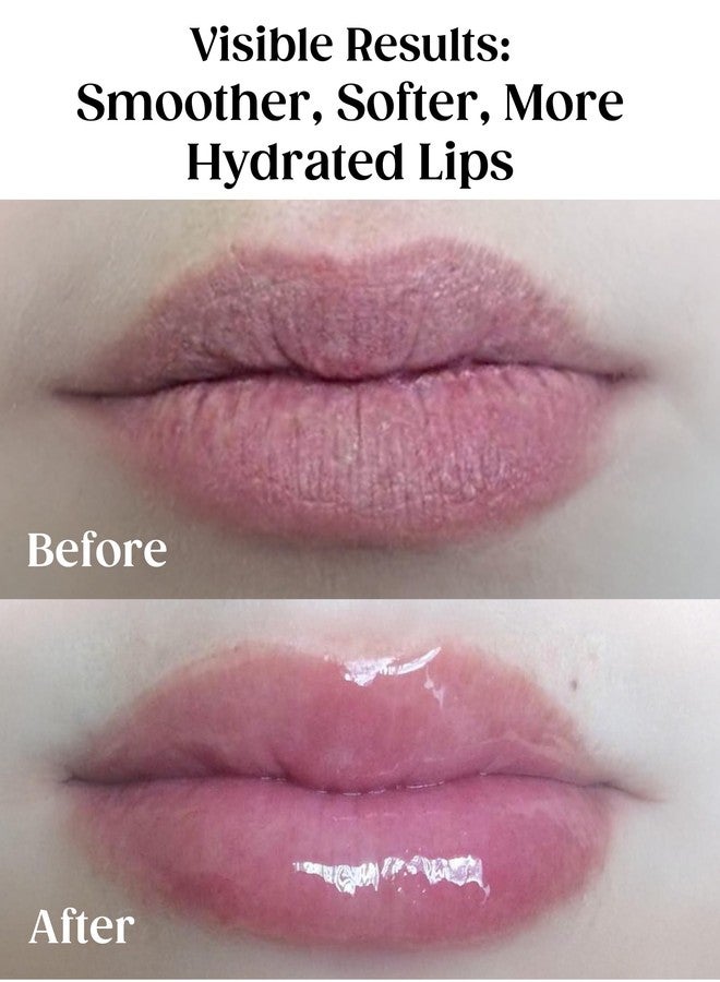 KAPLAN MD Perfect Pout Lip Mask & SPF 30 Lip Balm Duo – Hydrating Treatment with Hyaluronic Acid – Lip Mask (1 oz) + Rose Blush Balm (0.35 oz) - Image 2