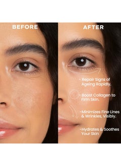 HYPHEN 0.1% Retinal Reset Serum Pro | 30% More Effective Than Retinol Serum| Advanced Anti Ageing Face Serum | Reduces Fine Lines & Wrinkles | Serum For Women And Men | Boosts Collagen, Hydrates & Soothes Skin-30 Ml  - Image 4