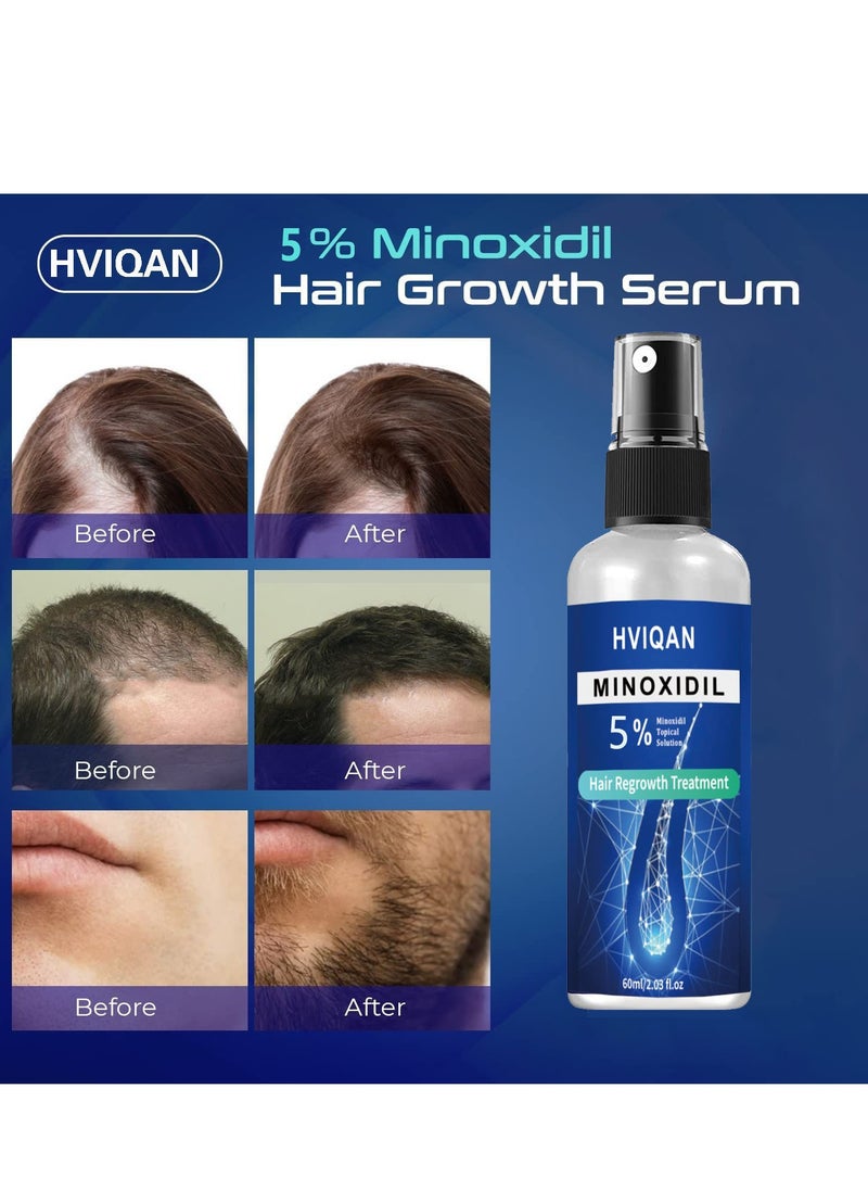 Hviqan - 5% Minoxidil Hair Growth Spray For Men and Women 60Ml Hair Regrowth Treatment Serum For Stronger Thicker Longer Hair Help to Stop Thinning and loss hair - Image 1