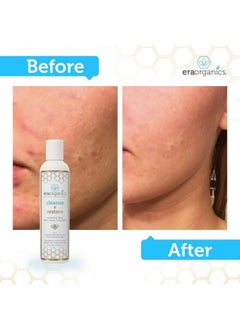 Era Organics Manuka Honey Face Wash For Women And Men Moisturizing Face Wash For Dry Skin With Organic Aloe Vera Soothing Gentle Face Cleanser Made In Usa Sulfate Free Facial Cleanser For Dry Skin 4 Oz  - Image 5