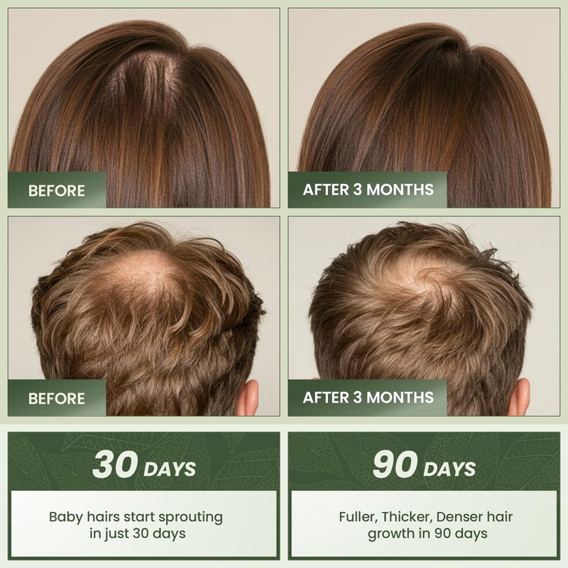 EssyNaturals Advanced Essynaturals Hair Growth Oil with Biotin - Caffeine and Castor Oil for Fuller, Thicker, Longer Hair - Image 3