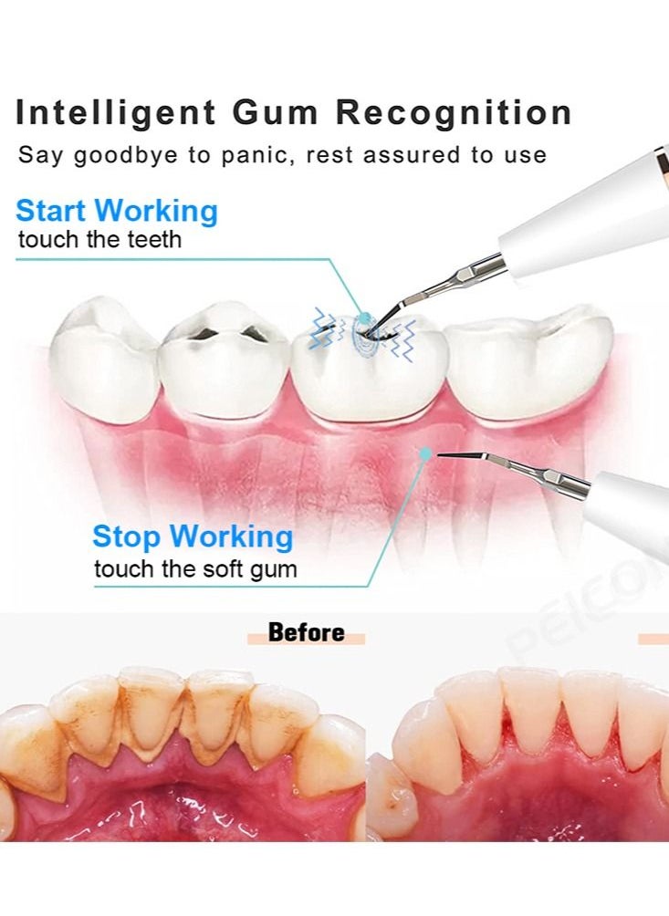 Joshberg - Ultrasonic Dental Scaler For Teeth Tartar Stain Tooth Calculus Remover Electric Sonic Teeth Plaque Cleaner Dental Stone Removal, Replaceable Clean Heads- Safe - Image 1