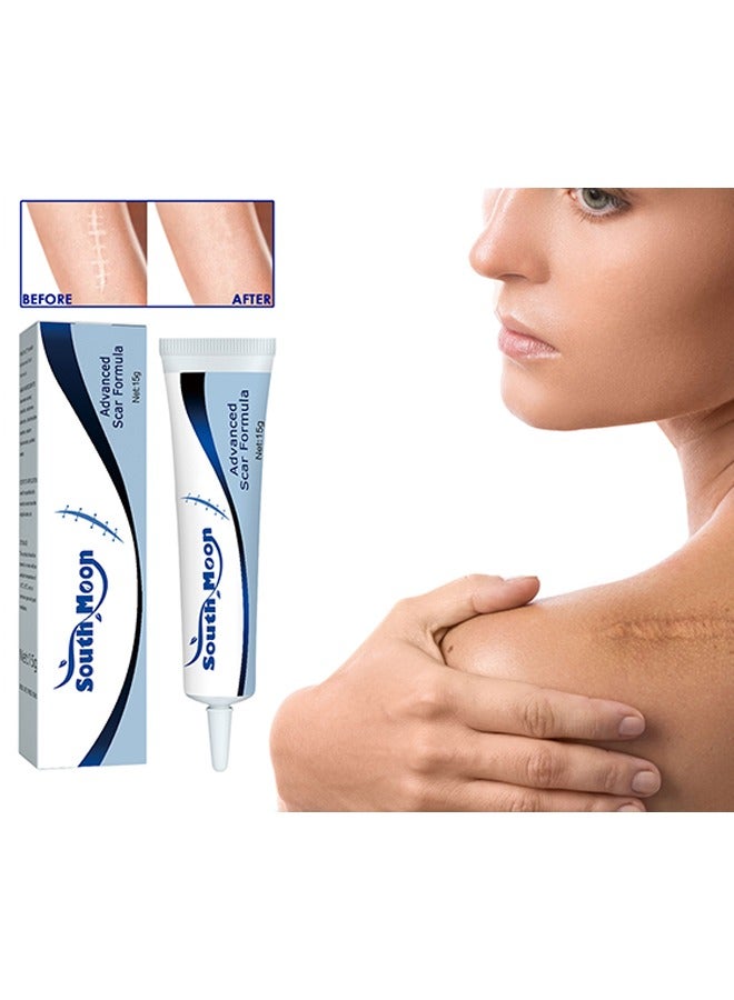 SOUTH MOON Advanced Scar Formula,Scar Repairing Gel,Wound-protecting scar gel burn wound caesarean section scar skin repair gel 15g - Image 1