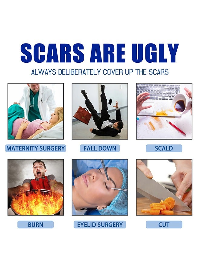 SOUTH MOON Advanced Scar Formula,Scar Repairing Gel,Wound-protecting scar gel burn wound caesarean section scar skin repair gel 15g - Image 5
