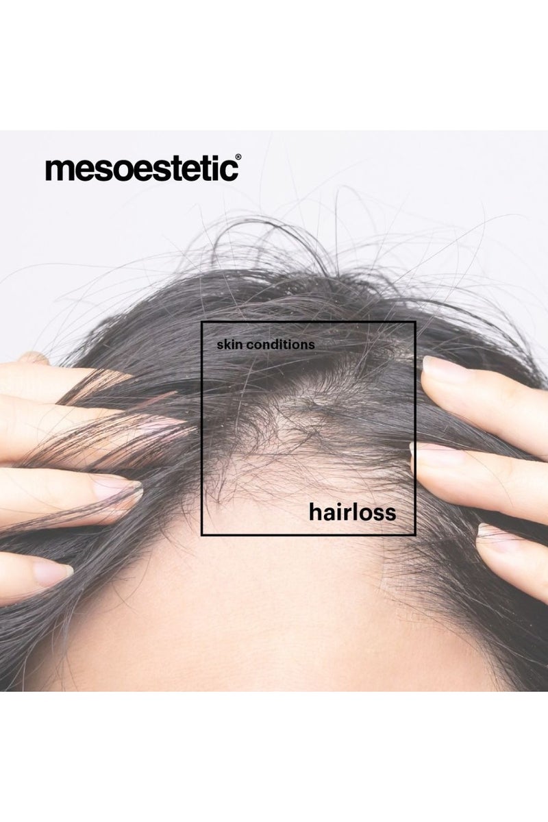 Mesoestetic Tricology Hair Loss Lotion for Hair Loss Control 8*5ml - Image 4