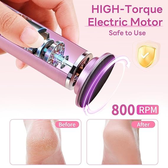 Roxbury Electric Callus Remover for Feet Powerful Electric Foot File for Painless Professional Foot Callus Remover with 60 Sanding Discs File Speed to - Image 3