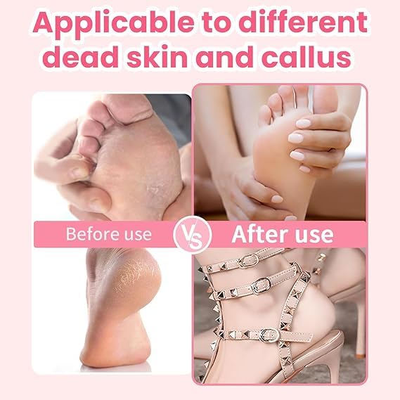 Roxbury Electric Callus Remover for Feet Powerful Electric Foot File for Painless Professional Foot Callus Remover with 60 Sanding Discs File Speed to - Image 5