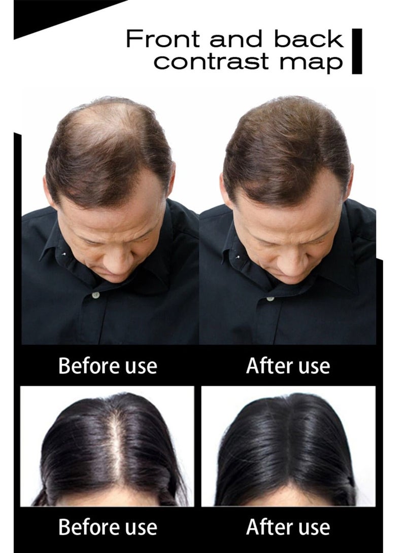 سيفيتش Hair Fibers Keratin Hairs Building Fiber Powder Instant Growth Refill - Image 5