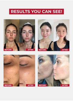 Face Fresh Set of 2 Gold Plus Beauty Cream - Removes Acne, Dark Spots, Fine Lines & Wrinkles - For All Skin Types 30g  - Image 2