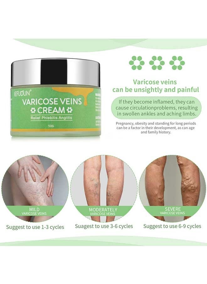 Sefudun - Varicose Veins Cream 50g, Spider Leg Repair Cream, Natural Varicose and Spider Veins Treatment, Strengthen Capillary Health/Improve Blood Circulation/Tired and Heavy Legs Fast Relief - Image 1