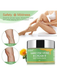 Varicose Veins Cream 50g, Spider Leg Repair Cream, Natural Varicose and Spider Veins Treatment, Strengthen Capillary Health/Improve Blood Circulation/Tired and Heavy Legs Fast Relief