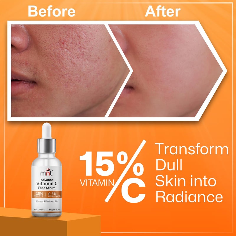 MNT 15 Vitamin C Face Serum with 05 Ferulic Acid for Glowing Skin I Brightens  Illuminates Skin I For Men  Women I 30 ml - Image 5
