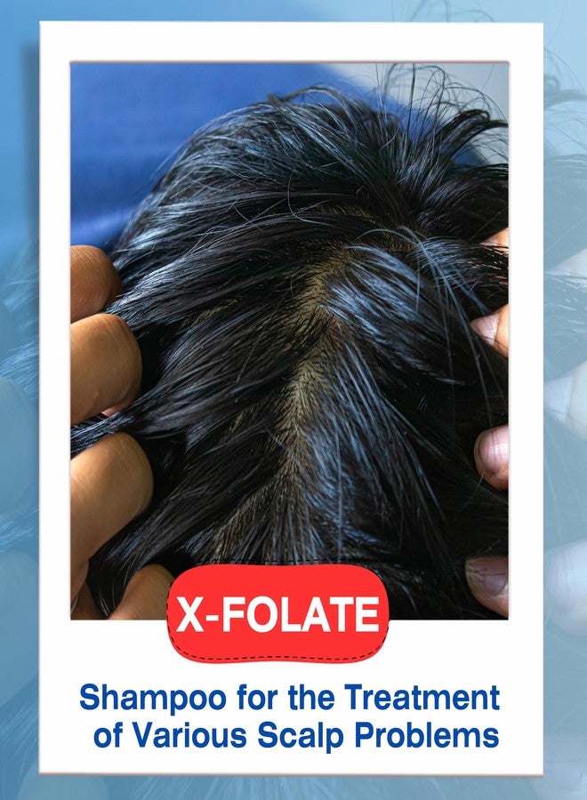 Mediceuticals X-Folate Shampoo Anti Dandruff Shampoo for Women and Men - Persistent Dandruff Control - For Scaly, Flaky Scalp and Scalp Buildup - Reduces Itching - 8.45 oz/ 250ml - Image 2