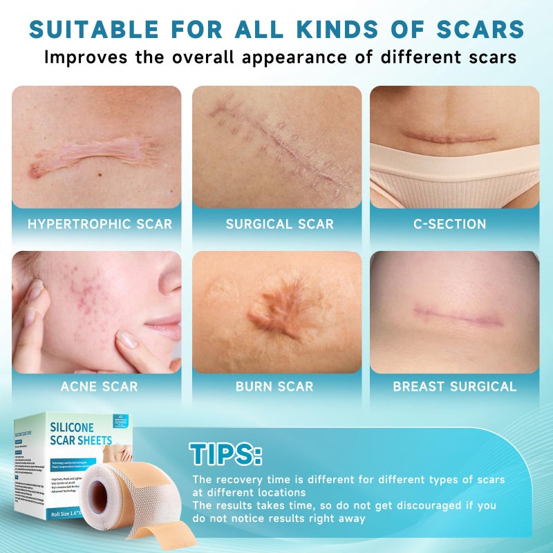 Rvlaim Silicone Scar Sheets, Silicone Scar Tape(1.6â€x 60â€ Roll-1.5M), Silicone Scar Strips, Professional Scar Removal Sheets for Surgical Scars, Keloid, C-Section, Burn et - Image 4
