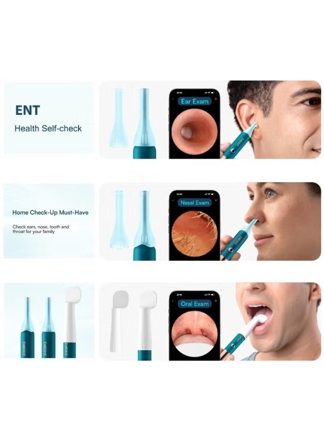 Bebird EarSight Ultra Smart Visual Earwax Removal Kit – 2K HD Medical-Grade Endoscopic Ear Camera with 5G WiFi, 3.6mm Flexible Silicone Tool, 60+ Pieces for Safe Ear Cleaning, ENT Health Check, & Facial Care for Adults, Kids, Infants & Elderly – USB-C Rechargeable Home Ear Care Device - Image 5