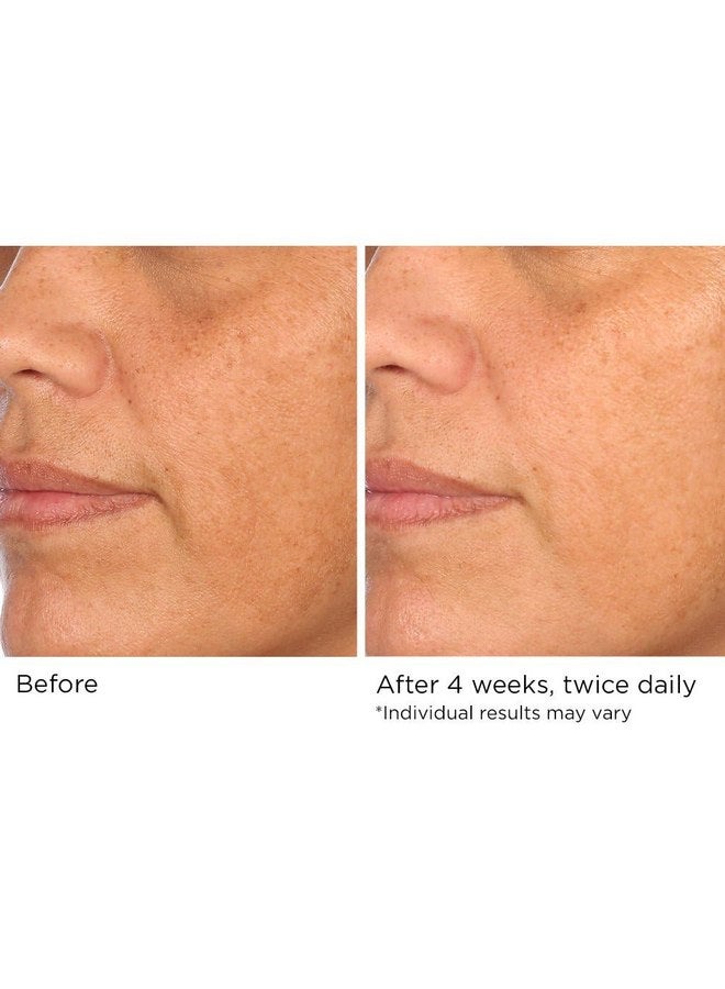 nassif md NassifMD Hydro-Screen - Clinical Grade Serum with Premium Ingredients: Ceramides, Retinol, Bakuchiol, Hyaluronic Acid - Anti Aging Treatment - Image 4