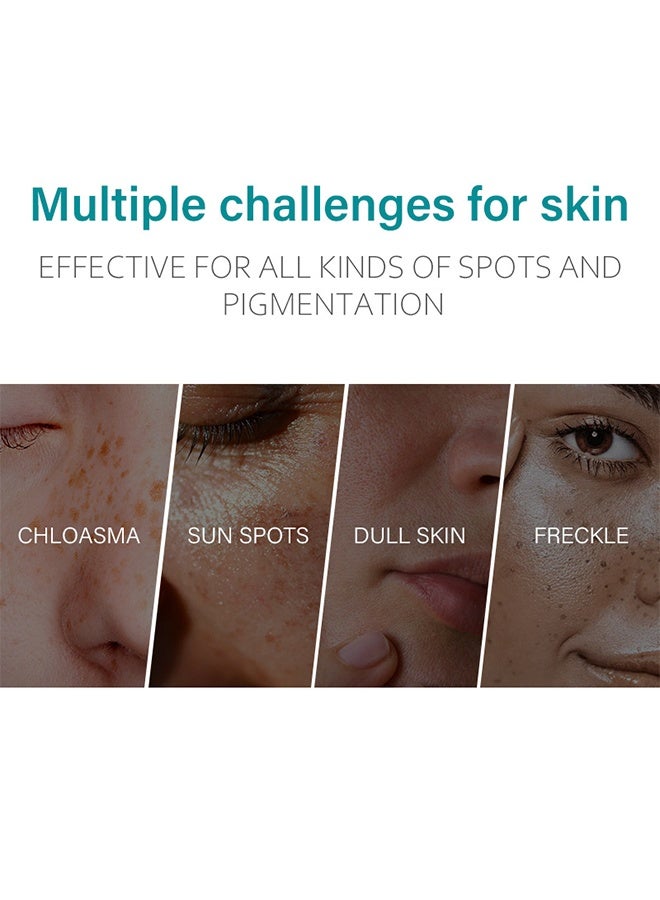 iBealee Dark Spot Remove Whitening Freckle Cream, for Face Peeling Skin Whitening Freckle Cream Pigmentation Treatment Sun Spots Age Spots Blemish Remover Lightening Cream 20ml - Image 2