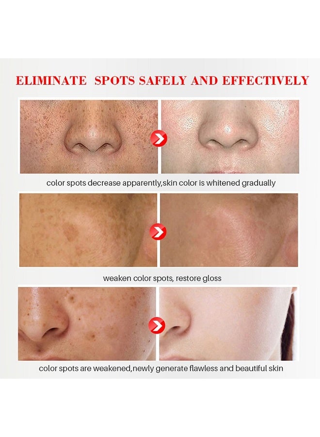 iBealee Dark Spot Remove Whitening Freckle Cream, for Face Peeling Skin Whitening Freckle Cream Pigmentation Treatment Sun Spots Age Spots Blemish Remover Lightening Cream 20ml - Image 5