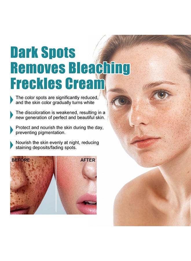 iBealee Dark Spot Remove Whitening Freckle Cream, for Face Peeling Skin Whitening Freckle Cream Pigmentation Treatment Sun Spots Age Spots Blemish Remover Lightening Cream 20ml - Image 3
