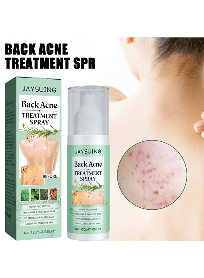 Jaysuing Back Acne Treatment Spray, 2% Salicylic Acid Spray, Body Acne Treatment with Herbal Formula, Body Acne Spray, Tea Tree Oil Spray, Acne Treatment For Teens, Back Acne 120ml - Image 1