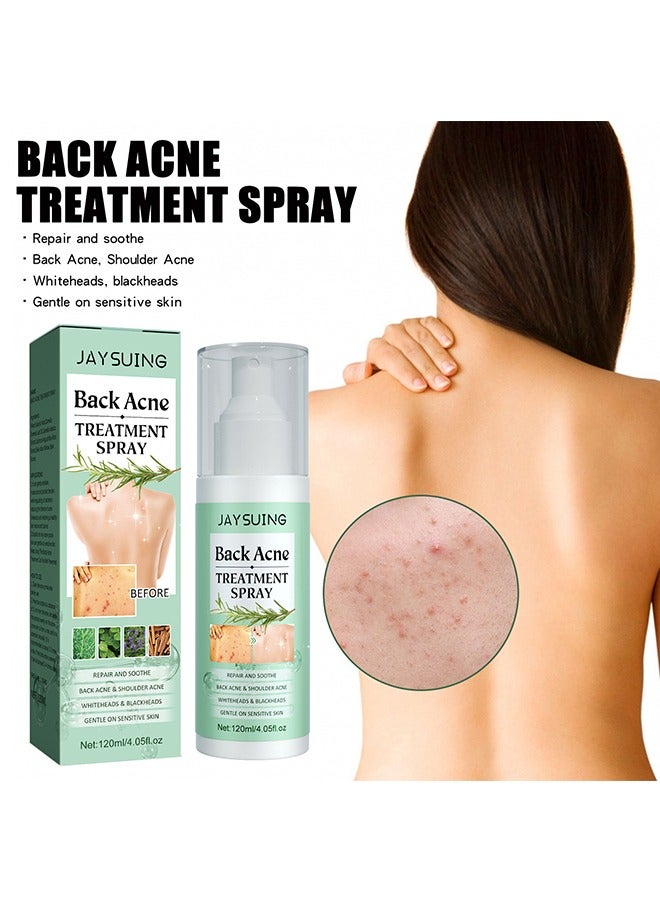 Jaysuing Back Acne Treatment Spray, 2% Salicylic Acid Spray, Body Acne Treatment with Herbal Formula, Body Acne Spray, Tea Tree Oil Spray, Acne Treatment For Teens, Back Acne 120ml - Image 2