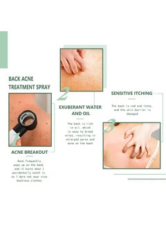 Jaysuing Back Acne Treatment Spray, 2% Salicylic Acid Spray, Body Acne Treatment with Herbal Formula, Body Acne Spray, Tea Tree Oil Spray, Acne Treatment For Teens, Back Acne 120ml  - Image 3