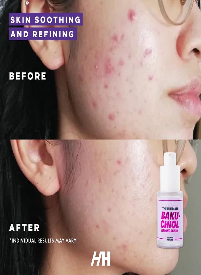 Handmade Heroes The Ultimate Bakuchiol Firming Face and Neck Lightweight Cream, Anti-Aging for Neck and Décolleté, Day & Night Face Cream - Moisturizing and Lifting - Image 2