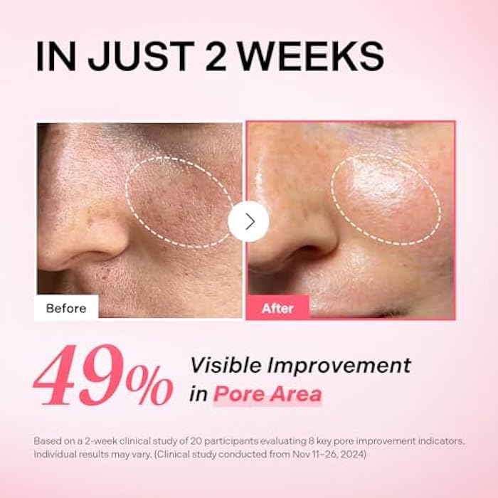Torriden CELLMAZING Pore Perfecting Ampoule 30ml (1.01 fl.oz.) | Improving Skin Elasticity | 5D Collagen, Peptide Complex, PHA, LHA | Korean Facial Serum, Korean Skin Care - Image 2