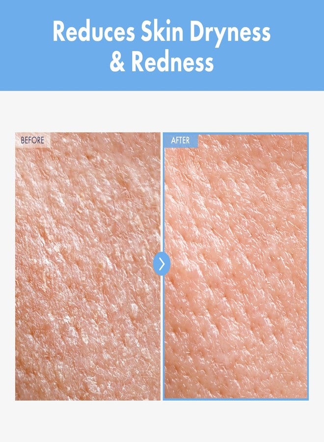 NATUREKIND كريم ناتشر كايند سيكا بانثينول، 50,000 جزء في المليون بانثينول، سنتيلا أسياتيكا وحمض الهيالورونيك، مرطب لإصلاح الحاجز للبشرة الجافة والحساسة، العناية بالبشرة الكورية، 150 جرام، 5.29 أونصة. - Image 2
