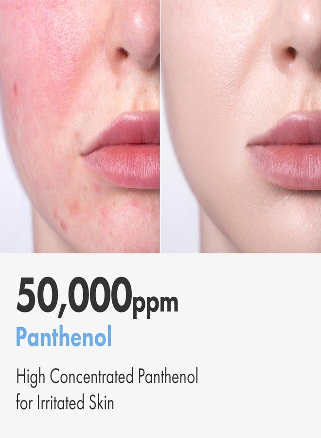 NATUREKIND كريم ناتشر كايند سيكا بانثينول، 50,000 جزء في المليون بانثينول، سنتيلا أسياتيكا وحمض الهيالورونيك، مرطب لإصلاح الحاجز للبشرة الجافة والحساسة، العناية بالبشرة الكورية، 150 جرام، 5.29 أونصة. - Image 3