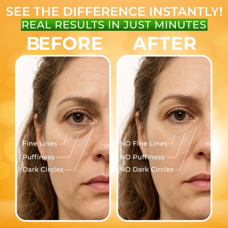 SEAMANTIKA Puffy Eye Treatment Instant results â€“ Naturally Eliminate Wrinkles, Puffiness, Dark Circle and Bags in Minutes â€“ Hydrating Eye Cream w/ Green Tea Extract, Dead Sea Minerals by SEAMANTIKA â€“ .8 fl.oz. - Image 4