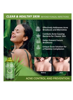 Roycederm Antifungal Body Wash & Soap, Antibacterial Tinea Versicolor Body Wash, Tea Tree Back Acne, Folliculitis Body Wash, For Jock Itch, Athletes Foot, Body Odor, Ringworm  - Image 2