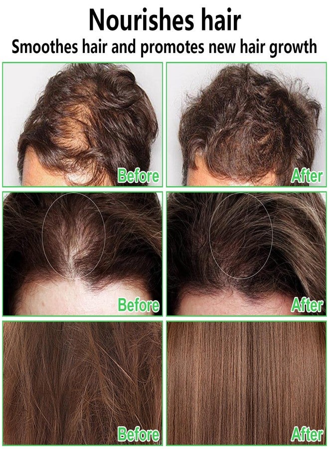 ليمونساك زيت باتانا الخام 100% من ليمونساك لنمو الشعر، زيت دكتور سيبي لنمو الشعر من هندوراس، طبيعي ونقي وغير مكرر وعضوي، لمكافحة تساقط الشعر، ويزيل تقصف الأطراف للرجال والنساء، 4.2 أونصة سائلة (المجموعة أ) - Image 3