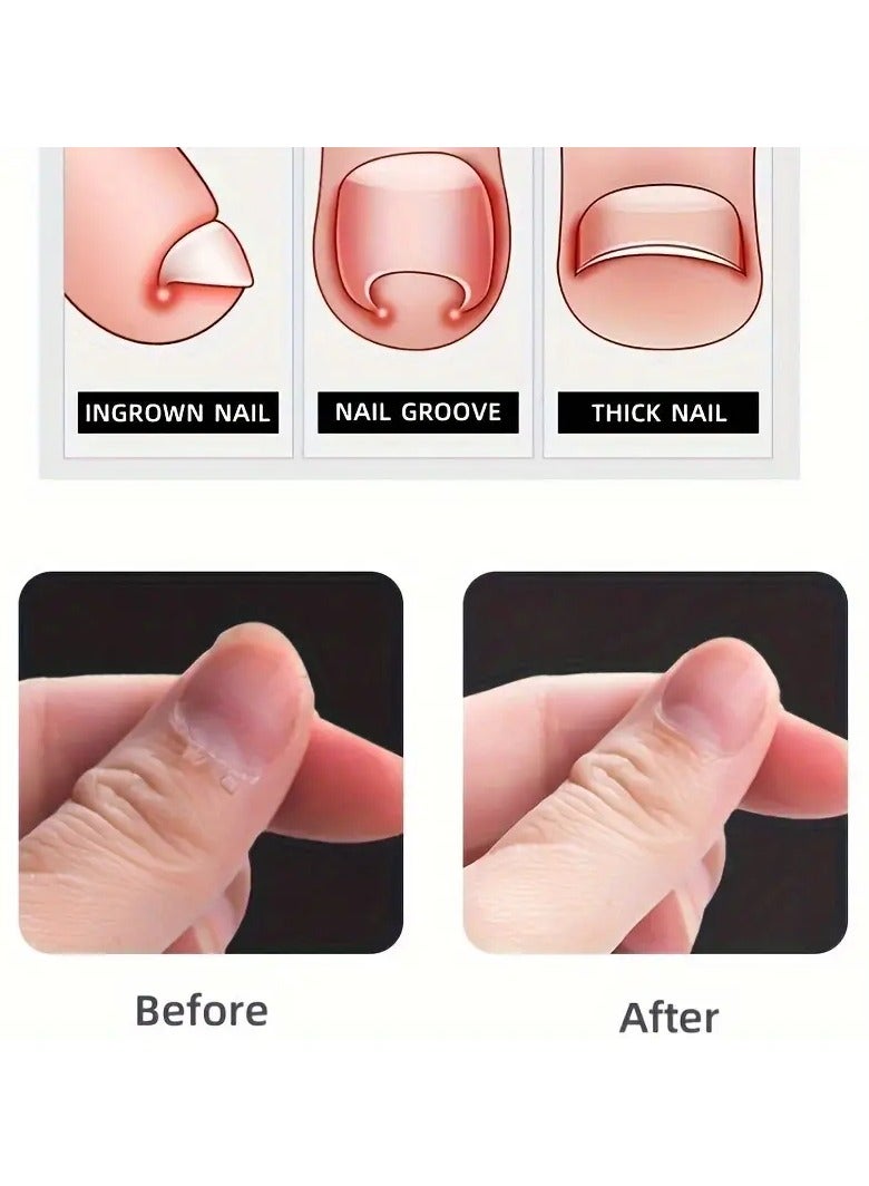 Goolsky Professional Cuticle Nippers - Portable Dead Skin Clipper for Nail Manicure and Exfoliation, Remove Old Skin, Burr, and Calluses with Ease - Ergonomic Design for Comfortable Grip - Image 4