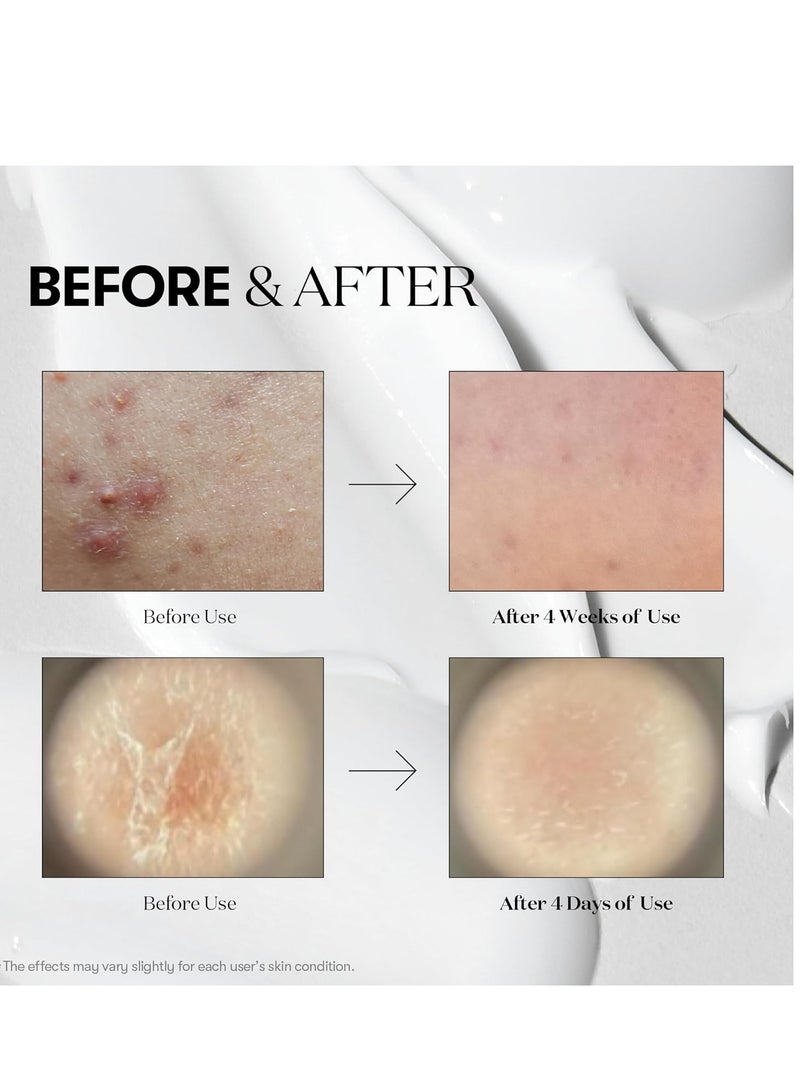 VT COSMETICS CICA + Hyalon Reedle Shot 700 Serum 30ml - Image 4