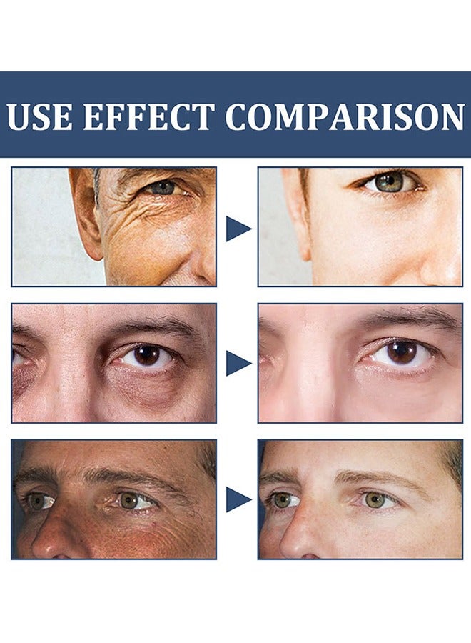 لينماي كريم الوجه للرجال, كريم مضاد للشيخوخة والتجاعيد للرجال مع الكولاجين، حمض الهيالورونيك، فيتامين ه، مزيل البقع الداكنة للرجال وعلاج كيس العين (50 مل) - Image 5