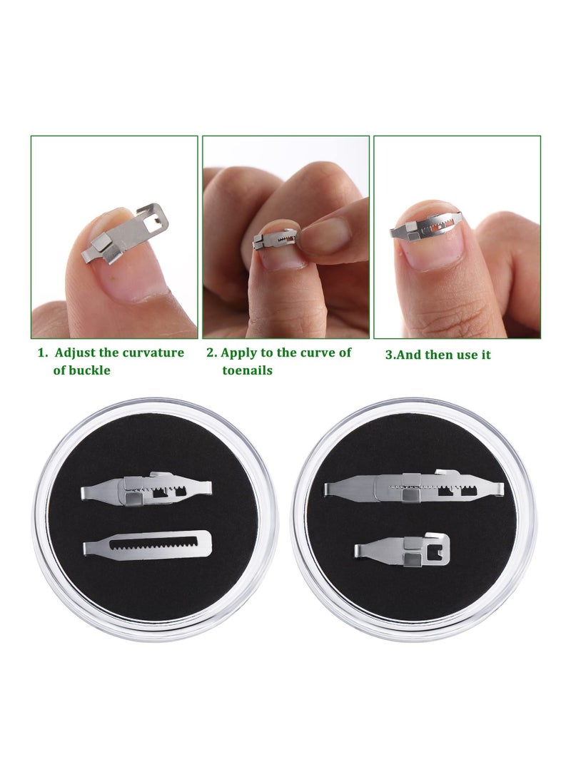 Excefore - Ingrown Straightening Clips Toenail Pedicure Tool Curved Brace Toenails Thick Paronychia Correction Tool, Ingrowing Nail Treatment Kit, 2 Sizes 4 Pcs - Image 1
