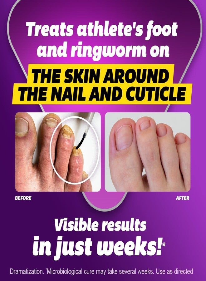 SILKA Max Strength Antifungal Liquid for Toenail Health with Brush Applicator, Results in 1 Week, Nail Fungus Treatment for Damaged Toenails, Athlete's Foot Treatment, Tolnaftate 1% 0.45 Fl Oz - Image 3