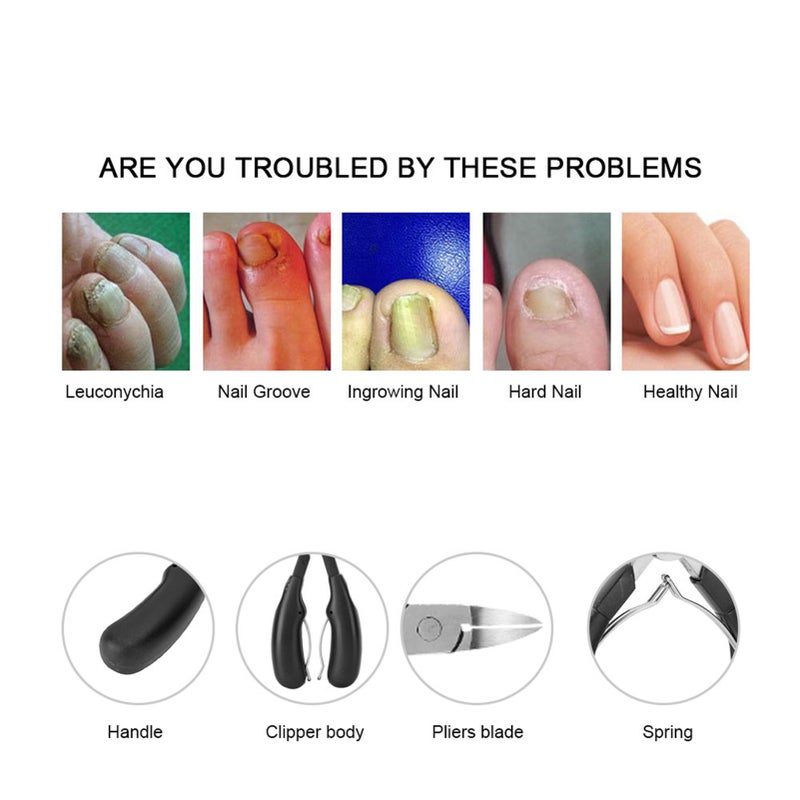 Stainless Steel Ingrown Toe Nail Clippers Fingernail Toenail Cuticle Scissors Pedicure Cutter ToolBlack - Image 1