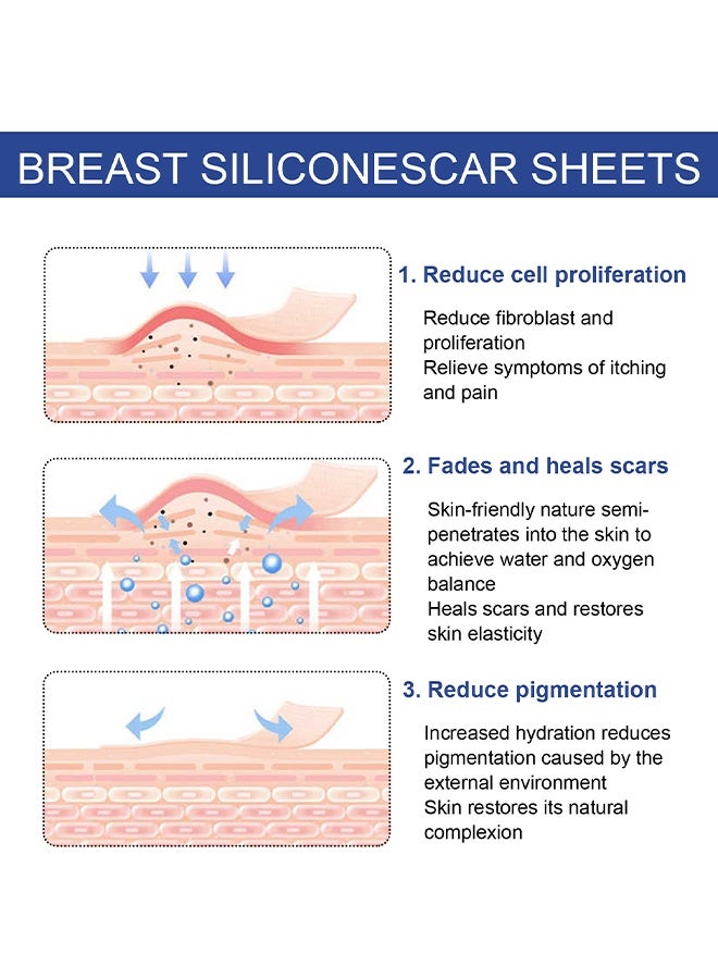 EELHOE Silicone Scar Sheets, Reusable Washable Silicone Scar Tape, Surgery Scars Removal Treatment, Medical Grade Silicone Scar Sheets For 4-Pairs  - Image 3