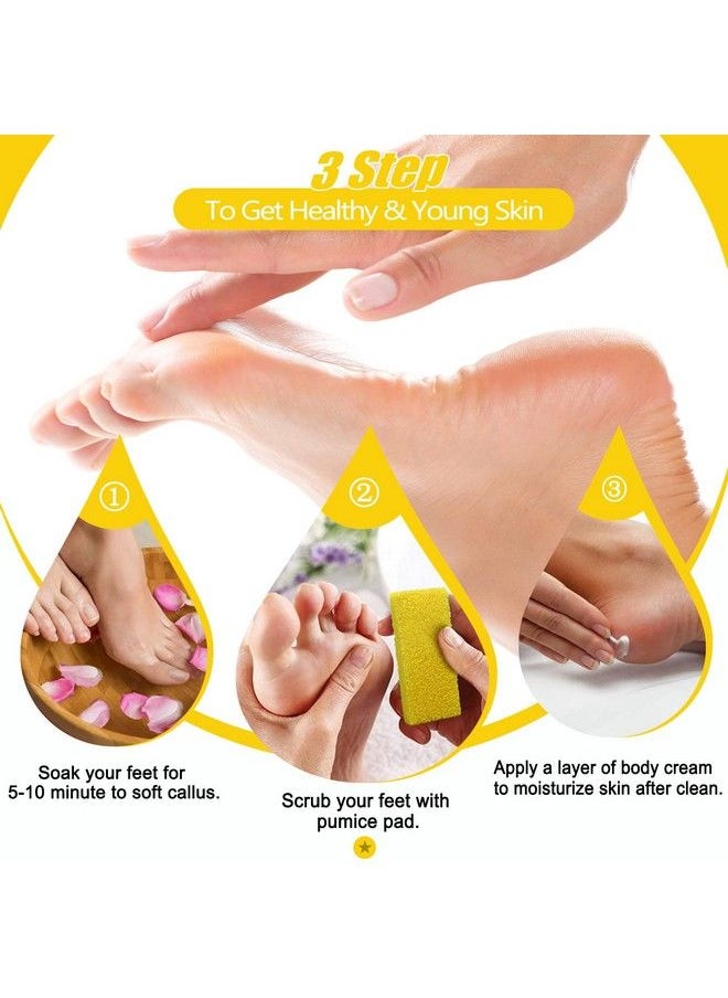 Salvmary - Disposable Foot Scrubber Sponge Pads Pedicure Pumice Stone For Feet Callus Remover Medium Coarse Yellow 40Pcs - Image 1