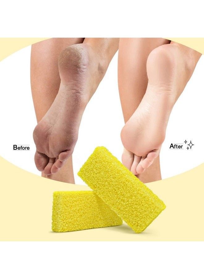 Salvmary - Disposable Foot Scrubber Sponge Pads Pedicure Pumice Stone For Feet Callus Remover Medium Coarse Yellow 40Pcs - Image 1