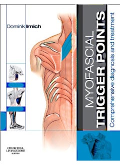 Myofascial Trigger Points: Comprehensive diagnosis and treatment