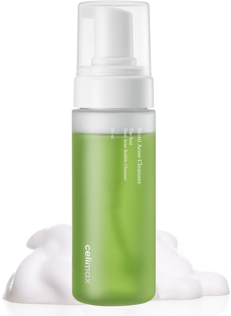 celimax The Real Noni Acne Bubble Cleanser 155ml - Image 1