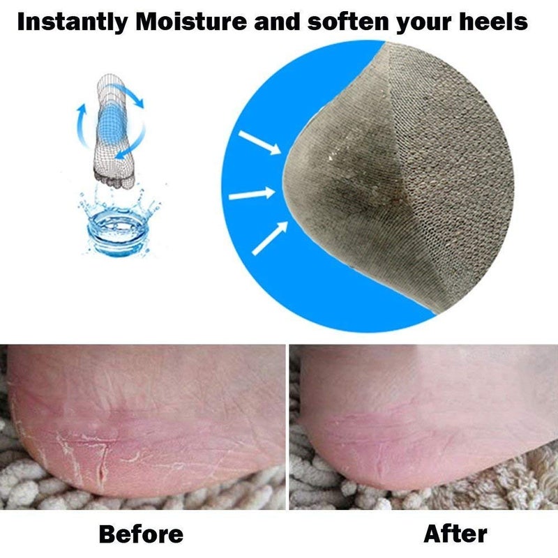 Codream Vented Moisturizing Socks Lotion Gel for Dry Cracked Heels, Spa Gel Socks Humectant Moisturizer Heel Balm Foot Treatment Care Heel Softener Compression (2 Pairs) - Image 5