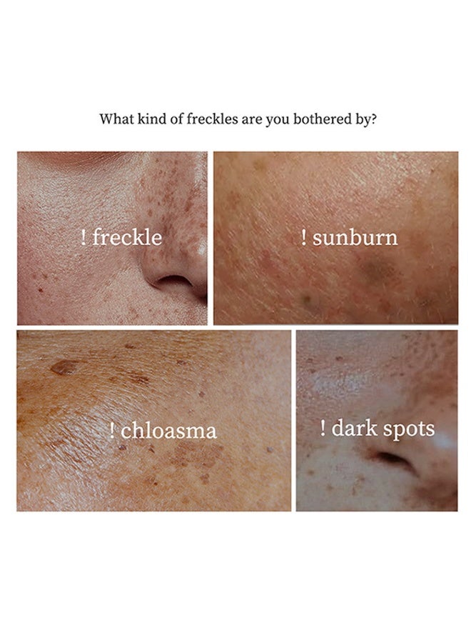 YOUBUY Whitening And Freckle Removing Cream,Dark Spot Corrector Remover Cream Whitening Moisturizing Brighten Complexion Improving Skin Barrier 20g - Image 4