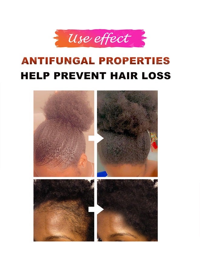 Sevich 100% Naturals Chebe Hair Oil，African Chebe Powder Serum, Hair Loss Treatments Repair Damaged Moisture Hair Regrowth Treatments 30ML - Image 5